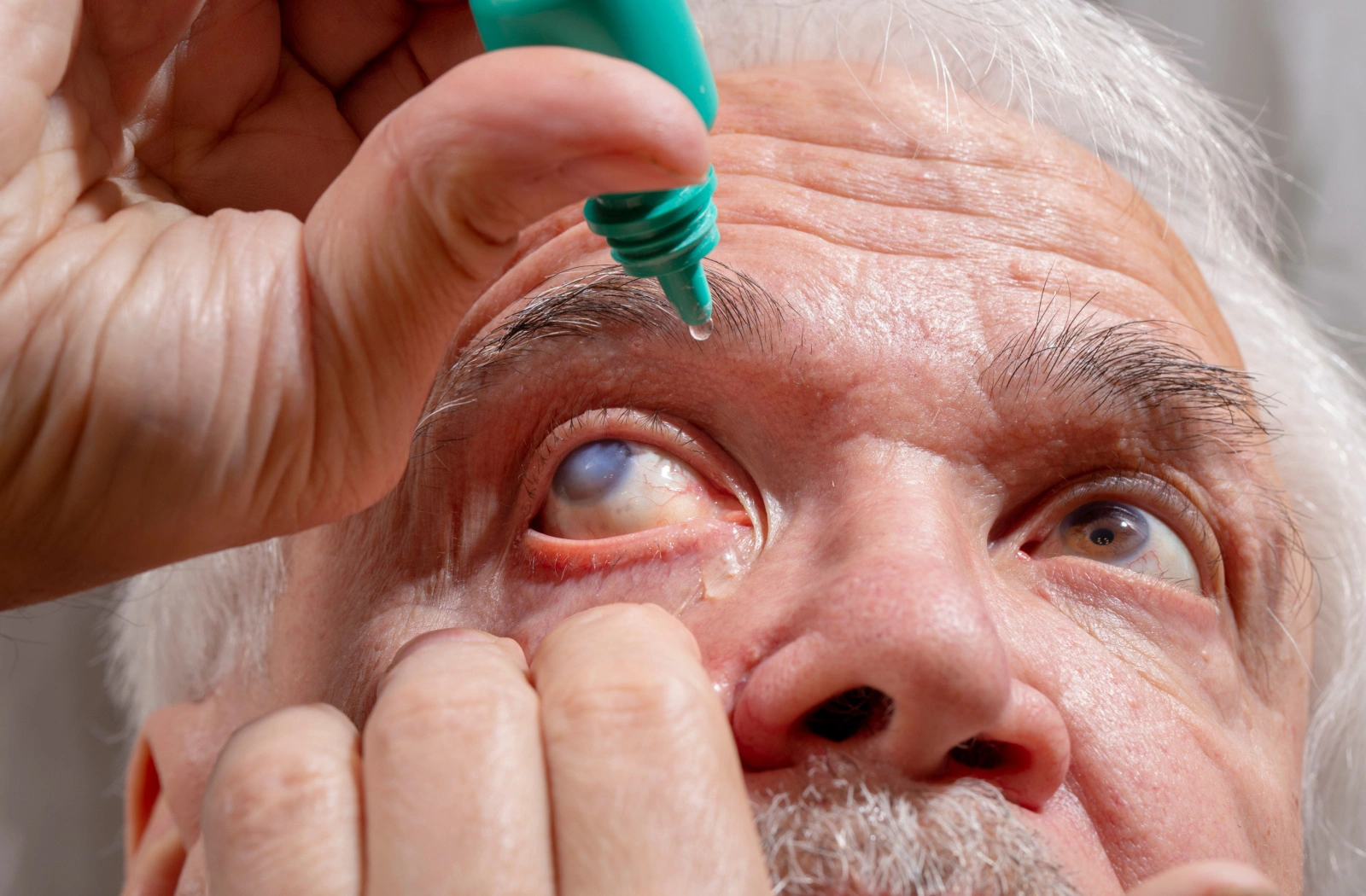 treatment for photosensitivity in seniors