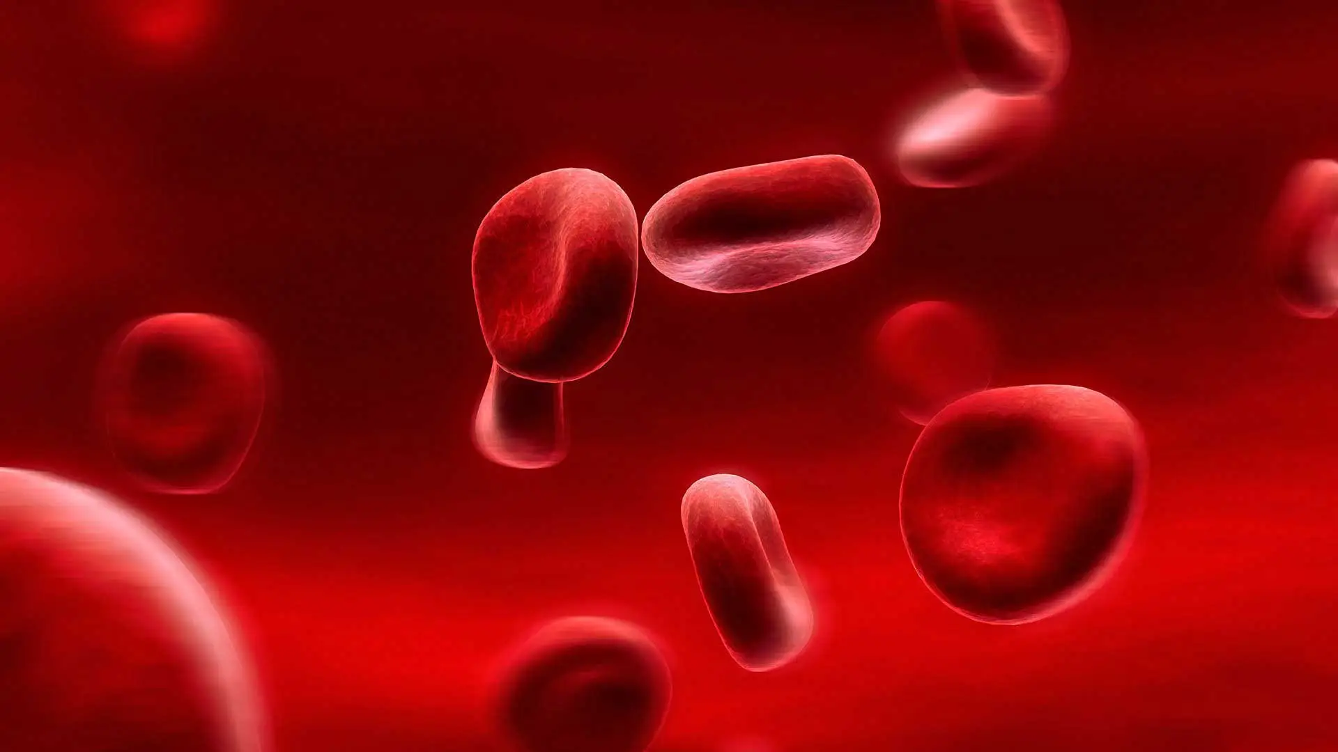 what are the 4 types of anemia in the elderly