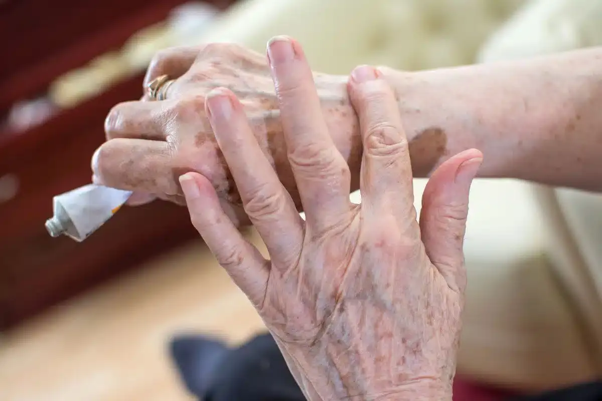 treatment for photosensitivity in seniors