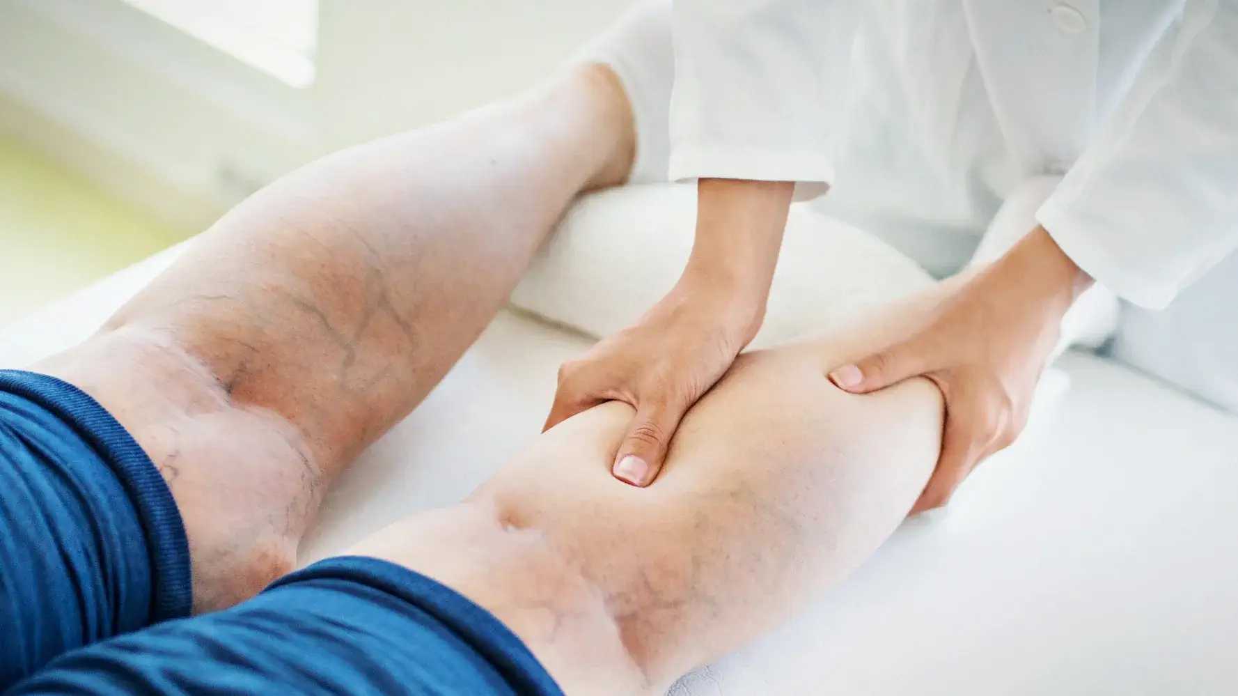 important tips for exercising for varicose veins