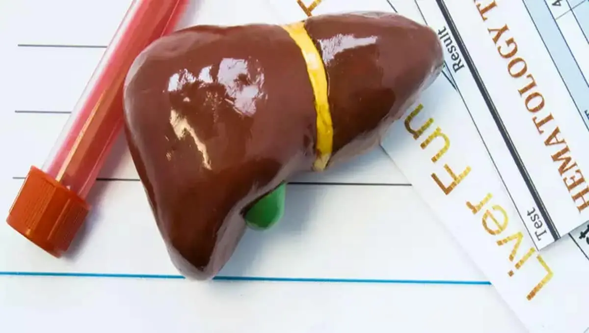 how does exercise help fatty liver