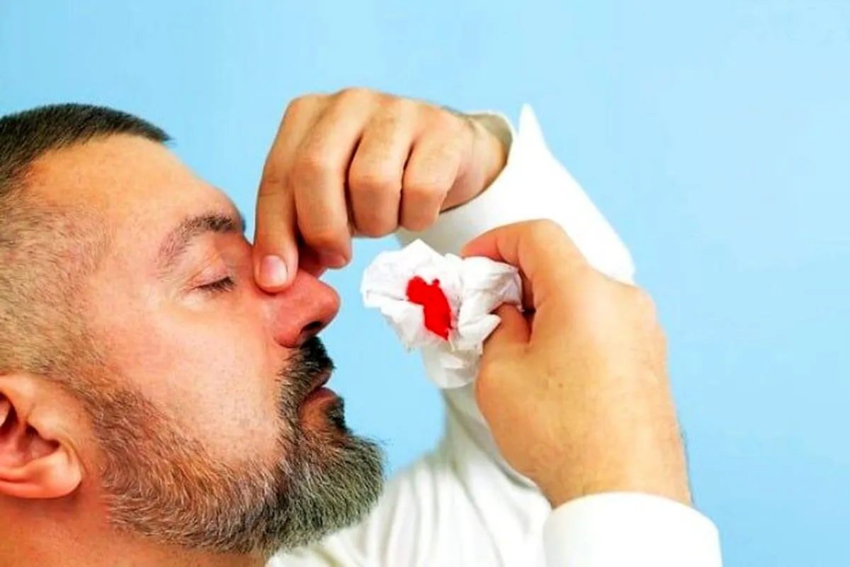how to cure nose bleeding in elderly