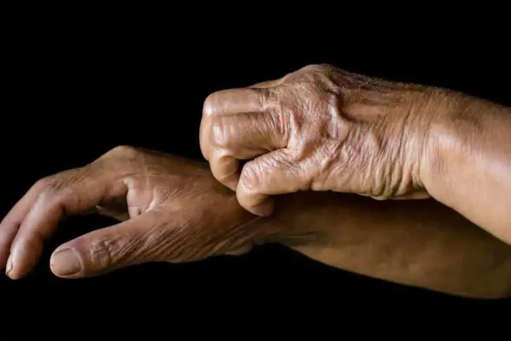 itching of body in elderly
