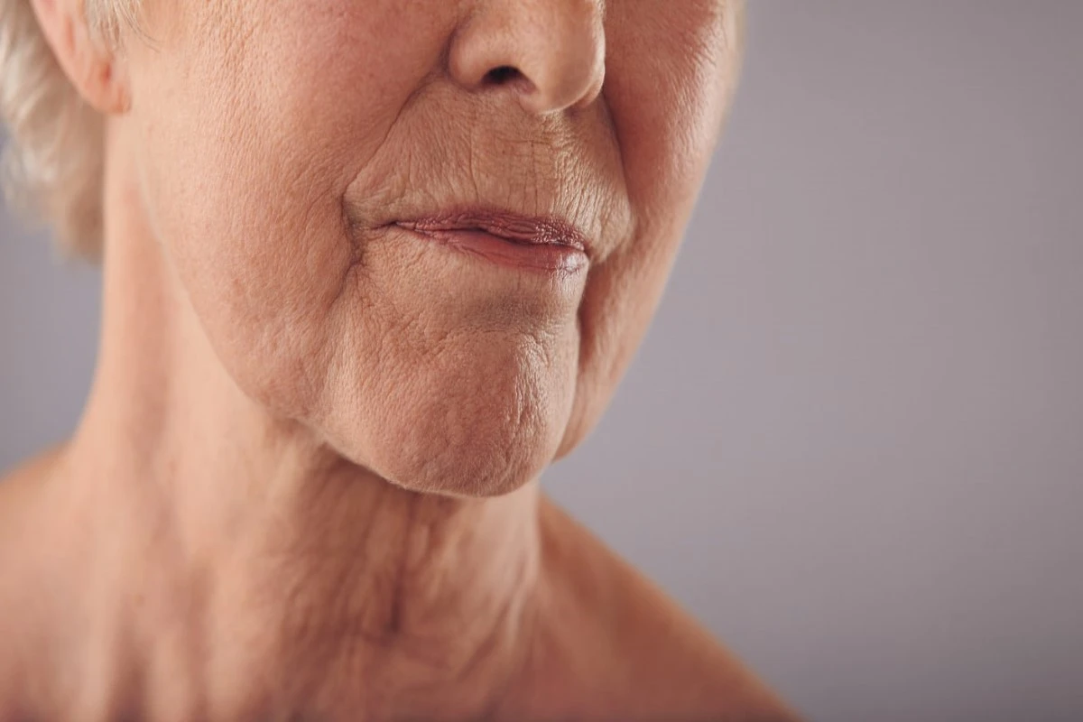 most common cause of dry skin in elderly