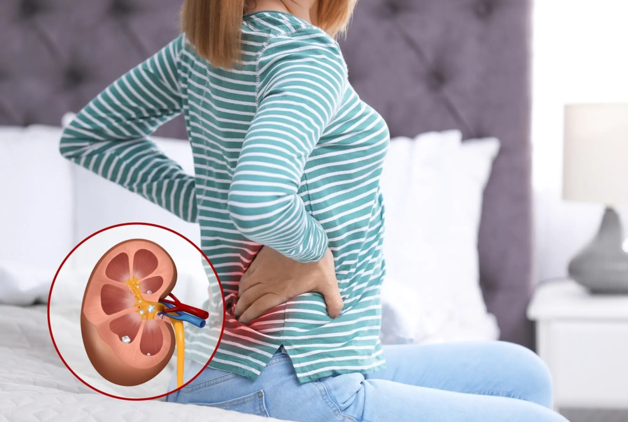 effective exercises to flush out kidney stones