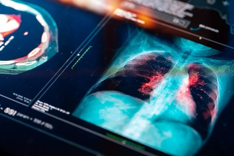 pneumonia prevention strategies for adults over 65