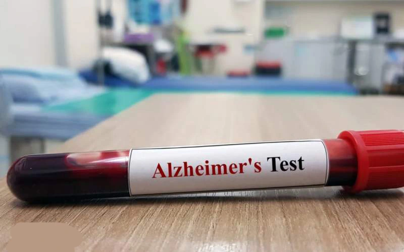 what is early alzheimer's test
